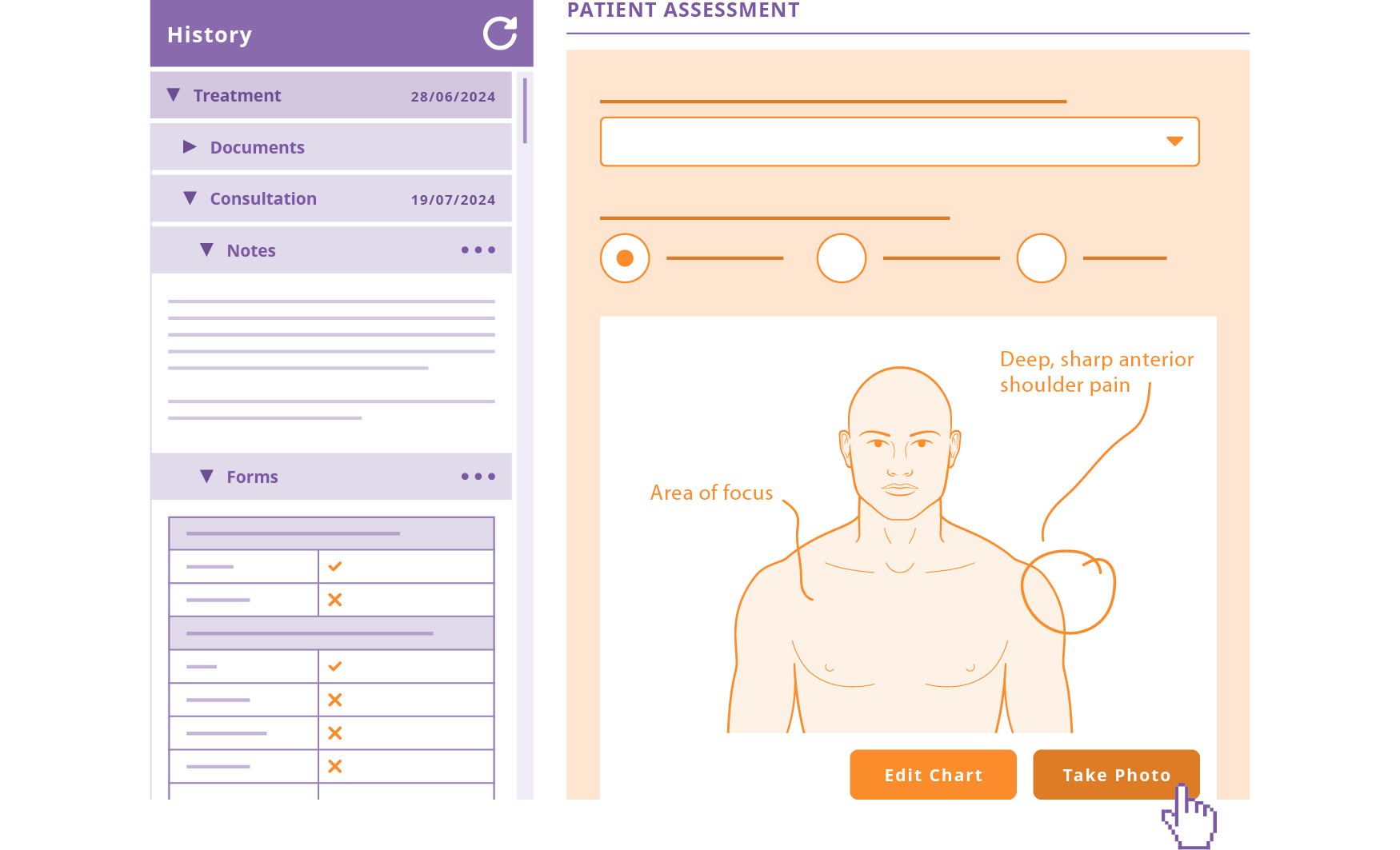 An example of the consultation or treatment notes facilities in PPS including a preview of a patient form that features a body chart